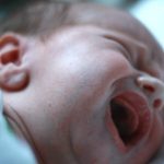 Reflusso gastroesofageo nel neonato