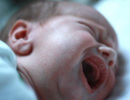 Reflusso gastroesofageo nel neonato